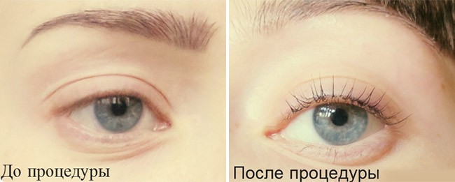 Ламинирования ресниц - до и после