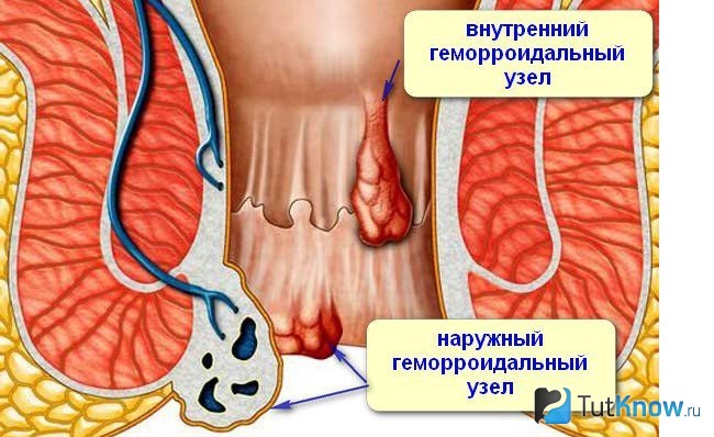 Схематическое изображение заднего прохода