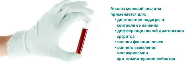 Пояснение необходимости анализа мочевины