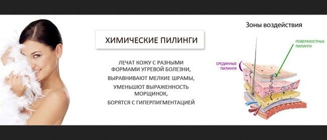 Пояснение о химическом пилинге