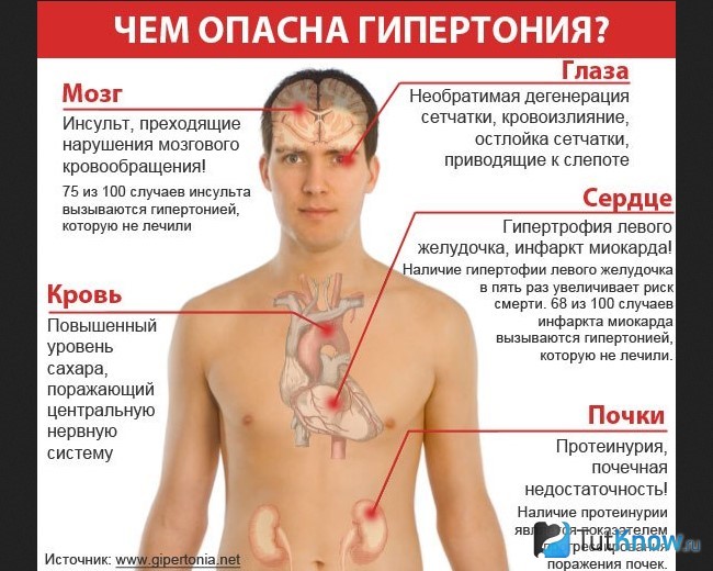 Схема опасностей гипертонии для организма