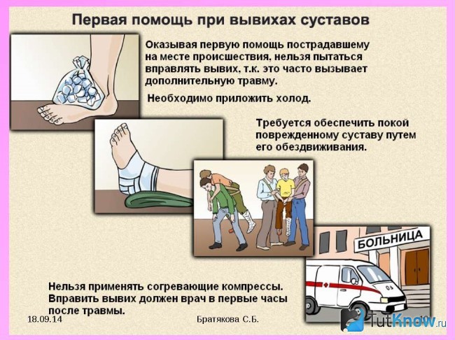 Первая помощь при вывихе суставов