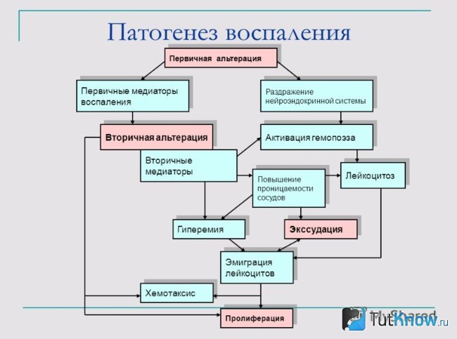 Схема патогенеза воспаления