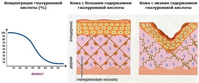 Действие гиалуроновой кислоты