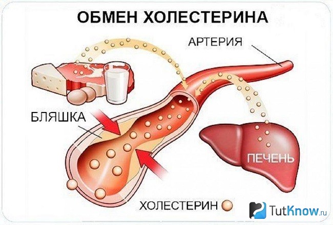 Схема обмена холестерина