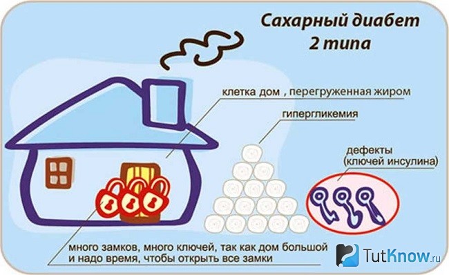 Справка о диабете второго типа