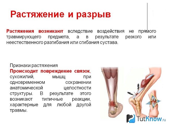 Справка о растяжении и разрыве