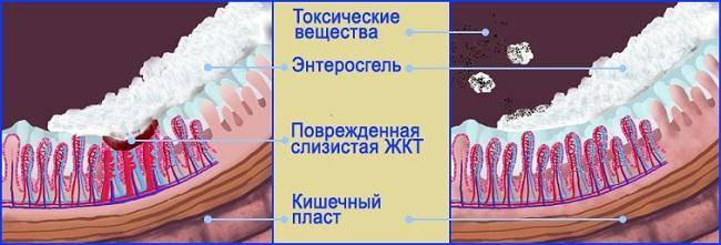 Действие Энтеросгеля
