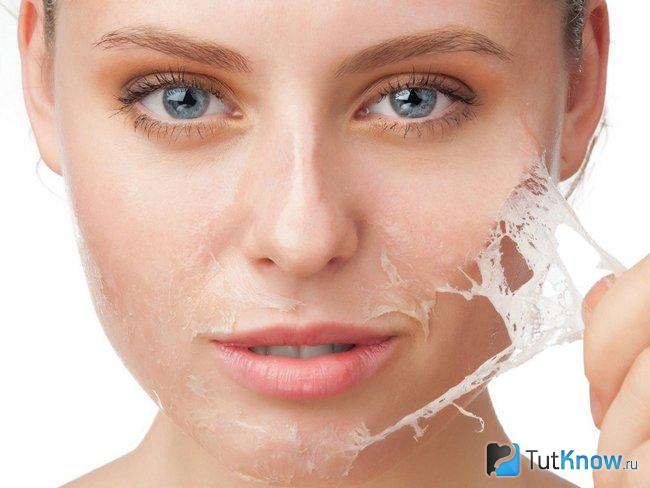 Графическое отображение сухой кожи на лице девушки