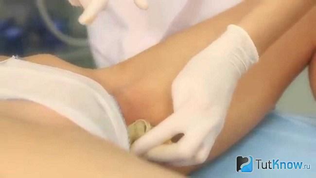 Девушке проводят процедуру шугаринга в интимной зоне