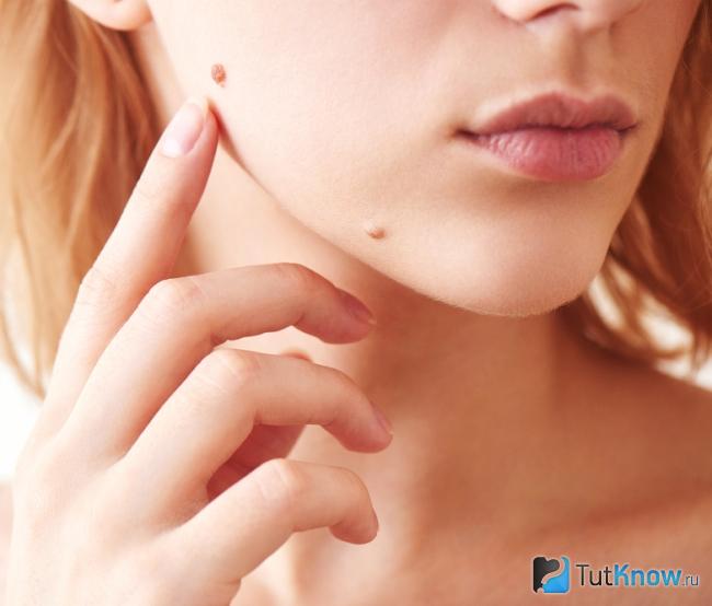 Невозможность скрыть родинки с помощью Skin Foundation