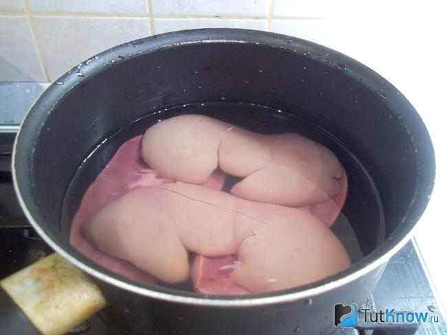 Почки залиты водой