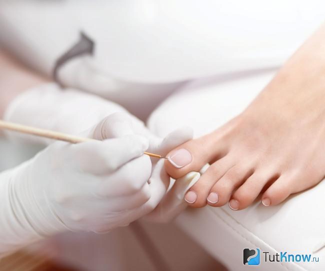 Качественный педикюр для профилактики врастания ногтей