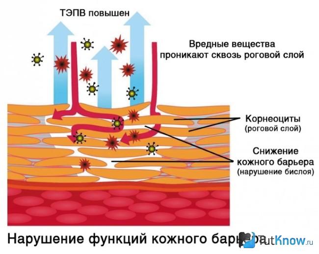 Изменение структуры рогового слоя кожи