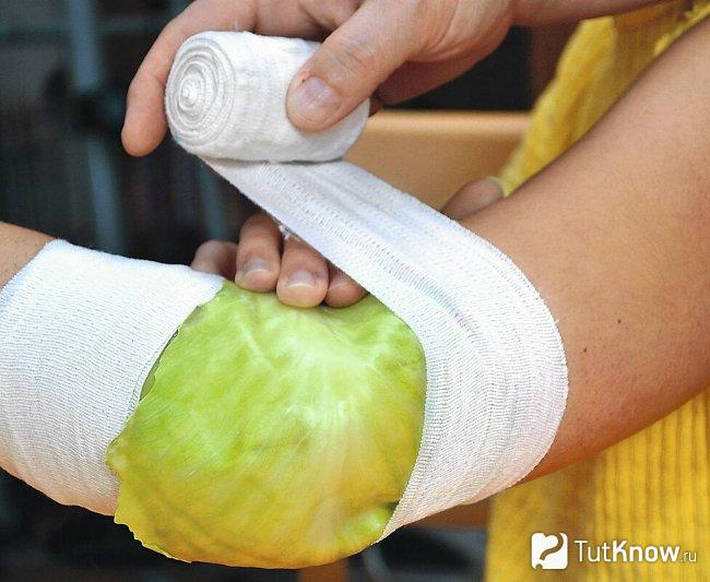 Капуста от ран